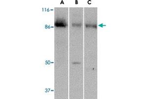 Western blot analysis of PTK7 in (A) human colon, (B) mouse kidney and (C) rat liver tissue lysate with PTK7 polyclonal antibody  at 1 ug/mL .