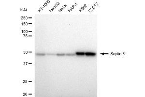 anti-Septin 8 (SEPT8) antibody