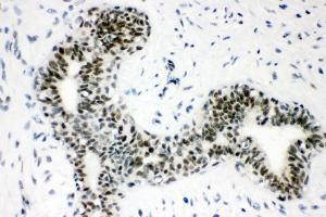 IHC analysis of Sumo 1/SUMO1 using anti-Sumo 1/SUMO1 antibody (ABIN7603002). (SUMO1 anticorps  (Middle Region))