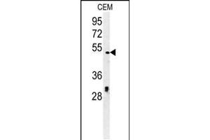 Western blot analysis in CEM cell line lysates (35ug/lane). (DSCC1 anticorps  (C-Term))