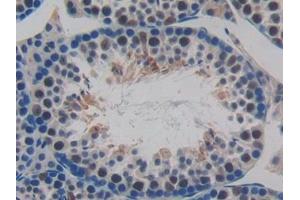 Detection of MCP2 in Mouse Testis Tissue using Polyclonal Antibody to Monocyte Chemotactic Protein 2 (MCP2) (CCL8 anticorps  (AA 20-94))