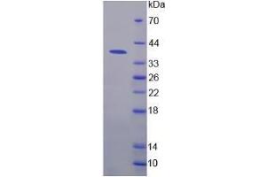SDS-PAGE analysis of Human Nuclear Factor kappa B Protein.