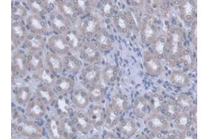 DAB staining on IHC-P; Samples: Rat Kidney Tissue