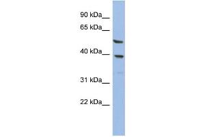 WB Suggested Anti-OLAH Antibody Titration: 0. (OLAH anticorps  (N-Term))
