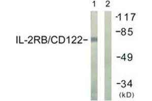 Western blot analysis of extracts from COS7 cells, using IL-2R beta/CD122 (Ab-364) Antibody. (IL2 Receptor beta anticorps  (AA 331-380))