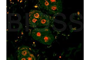 Formalin-fixed and paraffin-embedded rat skin labeled with Anti-?