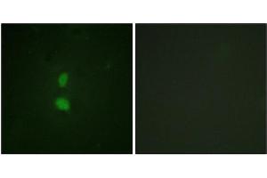 Immunofluorescence staining of methanol-fixed HuvEc cells using SNAI1 (Phospho-Ser246) Antibody.