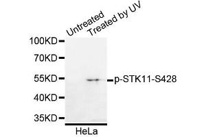 Western blot analysis of extracts of HeLa cells, using Phospho-STK11-S428 antibody (ABIN5995629). (LKB1 anticorps  (pSer428))