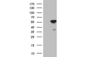 Western Blotting (WB) image for anti-4-Aminobutyrate Aminotransferase (ABAT) (AA 29-323) antibody (ABIN2715600)
