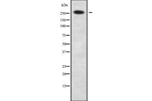 Western blot analysis NBAS using HuvEc whole cell lysates (NBAS anticorps  (Internal Region))
