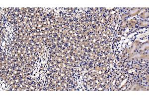 Detection of NFKB3 in Mouse Kidney Tissue using Polyclonal Antibody to Transcription Factor P65 (NFKB3)