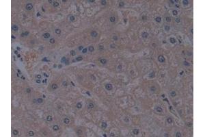Detection of TICAM1 in Human Liver Tissue using Polyclonal Antibody to Toll Like Receptor Adaptor Molecule 1 (TICAM1)