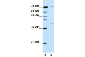 ZNF668 antibody (20R-1224) used at 0. (ZNF668 anticorps  (C-Term))