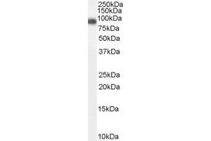 Western Blotting (WB) image for anti-ADAM Metallopeptidase Domain 23 (Adam23) (N-Term) antibody (ABIN2782599)