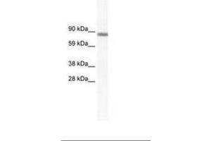 Image no. 1 for anti-GATA Zinc Finger Domain Containing 2A (GATAD2A) (N-Term) antibody (ABIN202841) (GATAD2A anticorps  (N-Term))