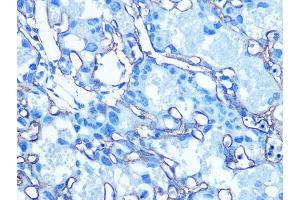 Immunohistochemistry of paraffin-embedded Mouse placenta using GLUT1/SLC2 antibody (ABIN6129475, ABIN6147954, ABIN6147956 and ABIN6222743) at dilution of 1:100 (40x lens). (GLUT1 anticorps  (AA 210-310))