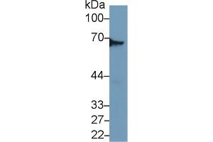 Western Blot; Sample: Mouse Lung lysate; Primary Ab: 1µg/ml Rabbit Anti-Mouse DPYSL3 Antibody Second Ab: 0.