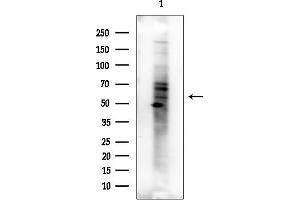 Western blot analysis of lysates from COLO205 cells(heat-shock treatment), using Phospho-Cytokeratin 20 (Ser13) Antibody at 1/1000 dilution.