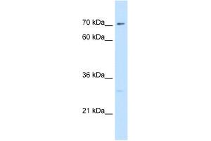 WB Suggested Antibody Titration:  5. (CTP Synthase anticorps  (N-Term))