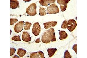 IHC analysis of FFPE human skeletal muscle stained with NAMPT antibody (NAMPT anticorps  (AA 400-426))