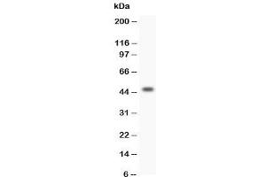 Western blot testing of HOXA3 antibody and SW620 lysate (HOXA3 anticorps  (C-Term))