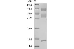 Transforming Growth Factor, beta 1 (TGFB1) (AA 30-390), (full length) protein (His-Avi Tag)