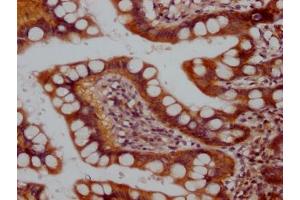 IHC image of ABIN7127787 diluted at 1:100 and staining in paraffin-embedded human small intestine tissue performed on a Leica BondTM system.