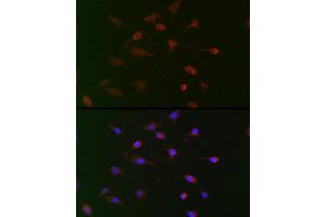 Immunofluorescence analysis of BALB-3T3 cells using CDC34 Rabbit pAb (ABIN6131558, ABIN6138257, ABIN6138258 and ABIN6221114) at dilution of 1:100 (40x lens). (CDC34 anticorps  (AA 1-236))