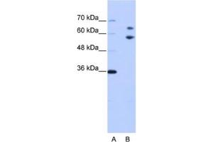 Western Blotting (WB) image for anti-TROVE Domain Family, Member 2 (TROVE2) antibody (ABIN2462170) (TROVE2 anticorps)