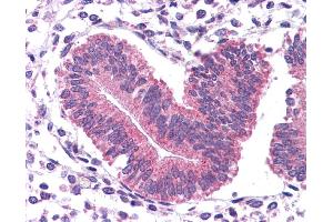 Immunohistochemistry with Human Uterus lysate tissue