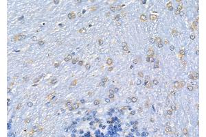 ABIN6262435 and ABIN6278088 at 1/100 staining Rat brain tissue by IHC-P. (ICAM-3/CD50 anticorps  (Internal Region))