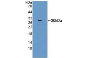 Detection of Recombinant EEF1a1, Human using Polyclonal Antibody to Eukaryotic Translation Elongation Factor 1 Alpha 1 (EEF1a1) (eEF1A1 anticorps  (AA 1-241))