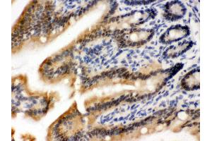 Anti- OGT Picoband antibody,IHC(P) IHC(P): Mouse Intestine Tissue (OGT anticorps  (C-Term))