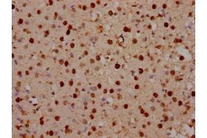 IHC image of ABIN7150394 diluted at 1:100 and staining in paraffin-embedded human brain tissue performed on a Leica BondTM system. (SATB2 anticorps  (AA 228-369))
