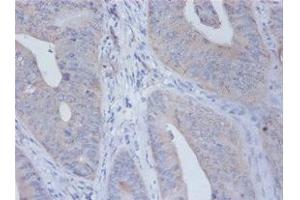 Immunohistochemistry of paraffin-embedded human placenta tissue using ABIN7156785 at dilution of 1:100