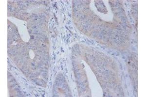 Immunohistochemistry of paraffin-embedded human placenta tissue using ABIN7156785 at dilution of 1:100 (IL12B anticorps  (AA 23-328))