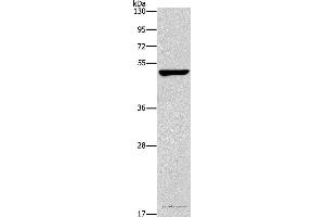 Western blot analysis of A549 cell, using CALCRL Polyclonal Antibody at dilution of 1:200 (CALCRL anticorps)