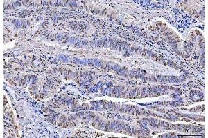 IHC analysis of KAP1 using anti-KAP1 antibody (ABIN3043491). (KAP1 anticorps  (AA 699-835))