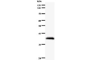 Western Blotting (WB) image for anti-Zinc Finger Protein 354A (ZNF354A) antibody (ABIN933131) (ZNF354A anticorps)
