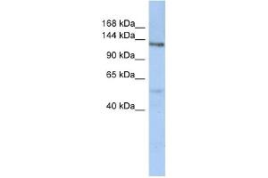 WB Suggested Anti-CHSY-2 Antibody Titration:  0. (CHSY3 anticorps  (N-Term))