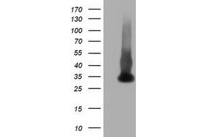 HEK293T cells were transfected with the pCMV6-ENTRY control (Left lane) or pCMV6-ENTRY ERCC1 (Right lane) cDNA for 48 hrs and lysed.