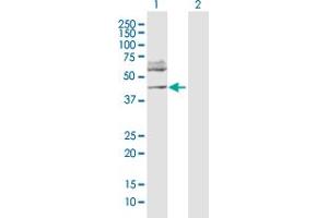 Western Blot analysis of FOXP3 expression in transfected 293T cell line by FOXP3 MaxPab polyclonal antibody. (FOXP3 anticorps  (AA 1-431))