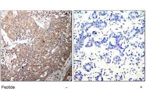 Image no. 1 for anti-Keratin 18 (KRT18) (AA 31-35) antibody (ABIN197580) (Cytokeratin 18 anticorps  (AA 31-35))