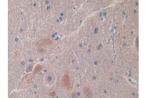 Used in DAB staining on fromalin fixed paraffin- embedded liver tissue (IL18BP anticorps  (AA 29-193))