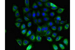 Immunofluorescent analysis of A549 cells using ABIN7154745 at dilution of 1:100 and Alexa Fluor 488-congugated AffiniPure Goat Anti-Rabbit IgG(H+L) (GNB5 anticorps  (AA 1-353))