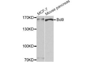 Western blot analysis of extracts of MCF7 and mouse pancreas cell lines, using Bcl9 antibody. (BCL9 anticorps)