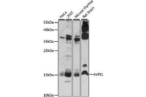 Western blot analysis of extracts of various cell lines, using AVPI1 antibody (ABIN6292453) at 1:1000 dilution. (AVPI1 anticorps)