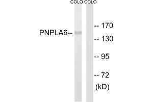Western blot analysis of extracts from COLO205 cells, using PNPLA6 antibody. (PNPLA6 anticorps  (N-Term))