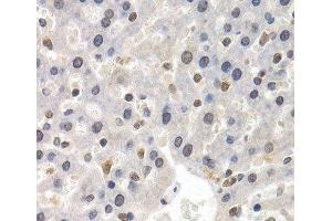 Immunohistochemistry of paraffin-embedded Rat liver using GTF2F1 Polyclonal Antibody at dilution of 1:200 (40x lens). (GTF2F1 anticorps)