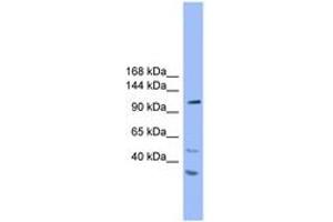 Image no. 1 for anti-StAR-Related Lipid Transfer (START) Domain Containing 8 (STARD8) (AA 201-250) antibody (ABIN6746633)